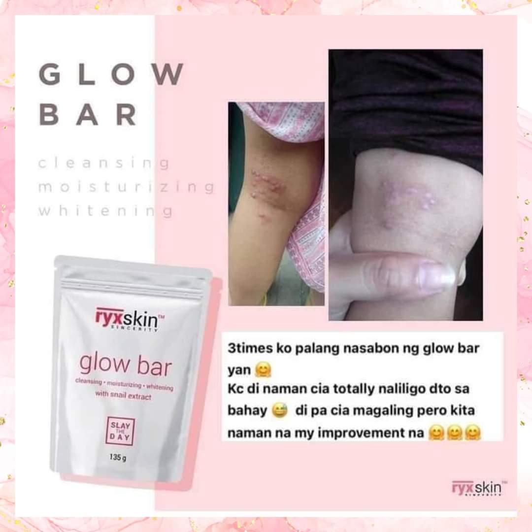 Ryx Glow Bar Soap | 135grams