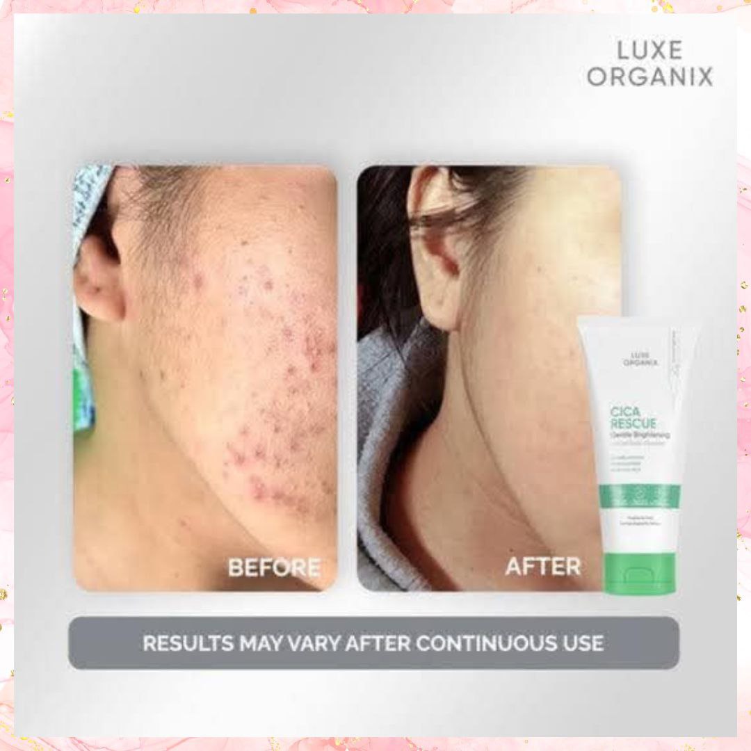 Luxe Organix CICA Rescue Gentle Brightening Cleanser | 150G