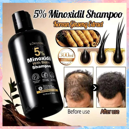 Kormesic 5% Minoxidil with Biotin Shampoo and Conditioner | 300ML each