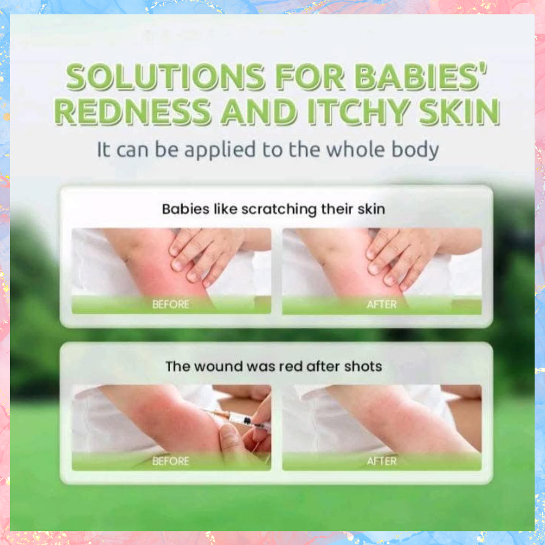 Tenderoo Baby Natural Soothing Roll-On | Gentle Relief for Itchy & Irritated Baby Skin | 360° Cool Roller - 15ml