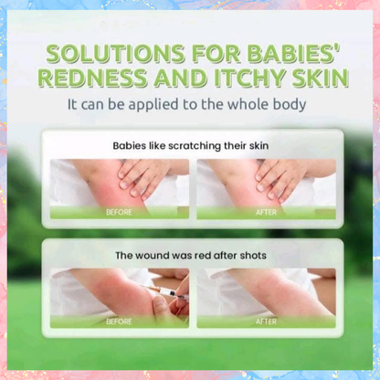 Tenderoo Baby Natural Soothing Roll-On | Gentle Relief for Itchy & Irritated Baby Skin | 360° Cool Roller - 15ml
