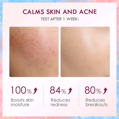 The Originote Hyalucera Moisturizer Gel