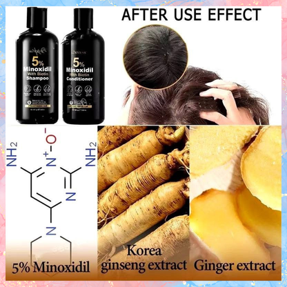 Kormesic 5% Minoxidil with Biotin Shampoo and Conditioner | 300ML each