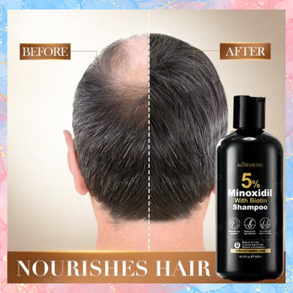 Kormesic 5% Minoxidil with Biotin Shampoo and Conditioner | 300ML each