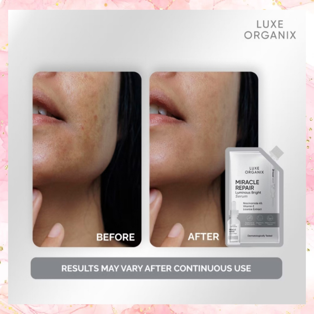 Luxe Organix Miracle Repair Luminous Bright Serum | 7ML