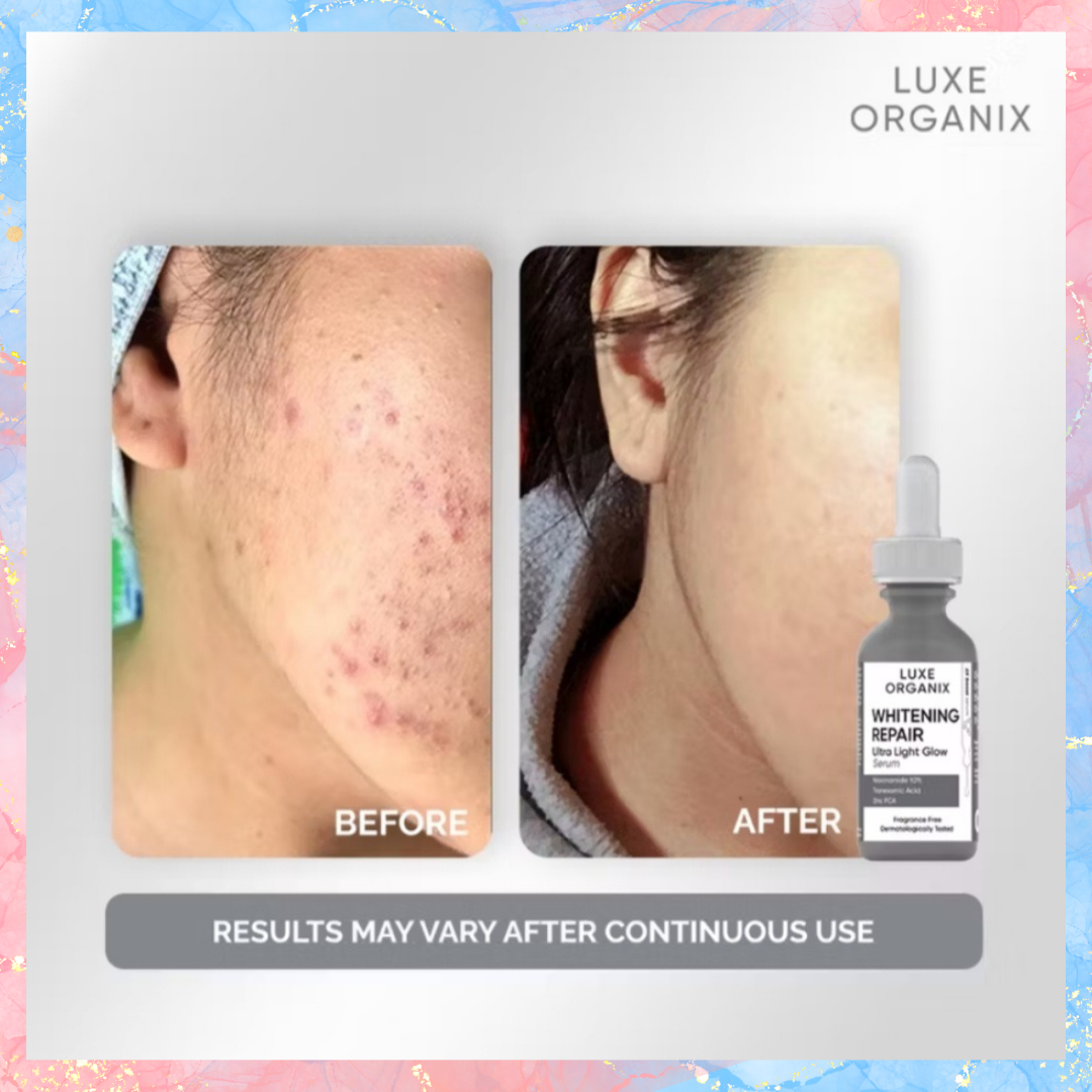 Luxe Organix Whitening Repair Ultra Light Glow Serum | 30ML