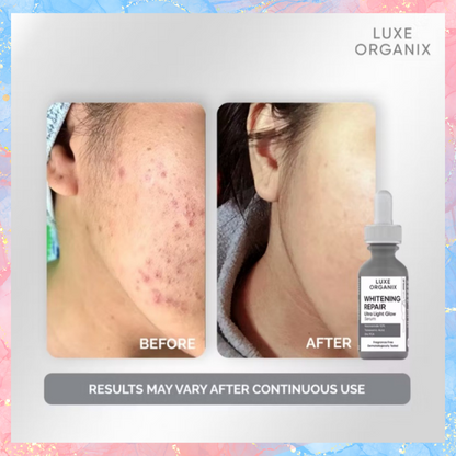 Luxe Organix Whitening Repair Ultra Light Glow Serum | 30ML