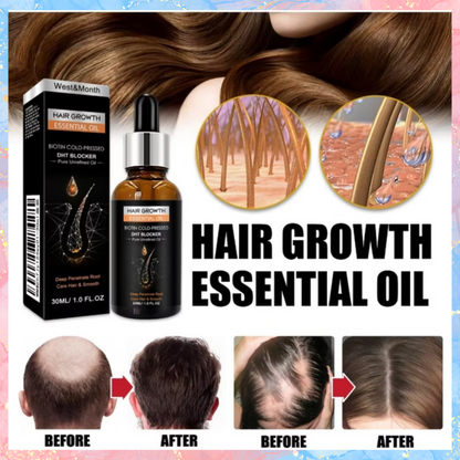 West&Month Hair Growth Essential Oil | Biotin Cold-Pressed | 30ML