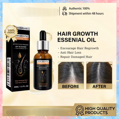 West&Month Hair Growth Essential Oil | Biotin Cold-Pressed | 30ML